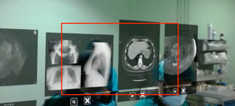 En el cuadrado, y a ojo, lo que de verdad se ve cuando llevas puestas unas Hololens. La imagen se ve borrosa porque proviene del streaming que hacen la gafas, pero en realidad la resoluciĂłn es bastante buena.